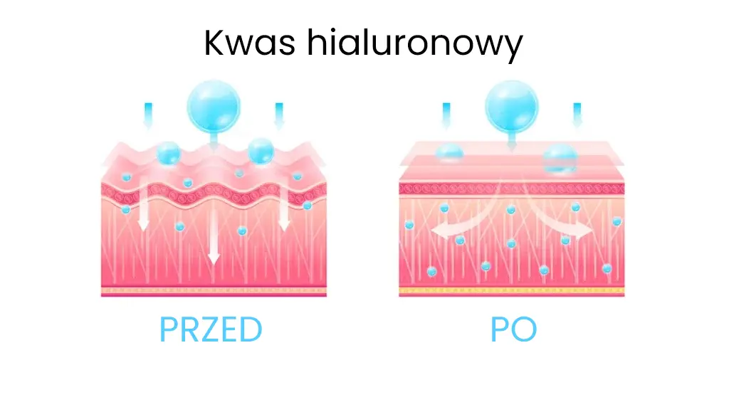 Zasada działania kwasu hialuronowego