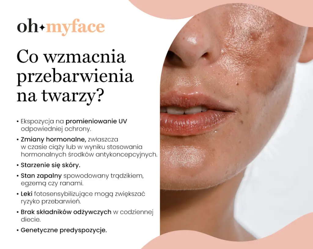 Czynniki wzmagające przebarwienia twarzy w infografice Oh My Face