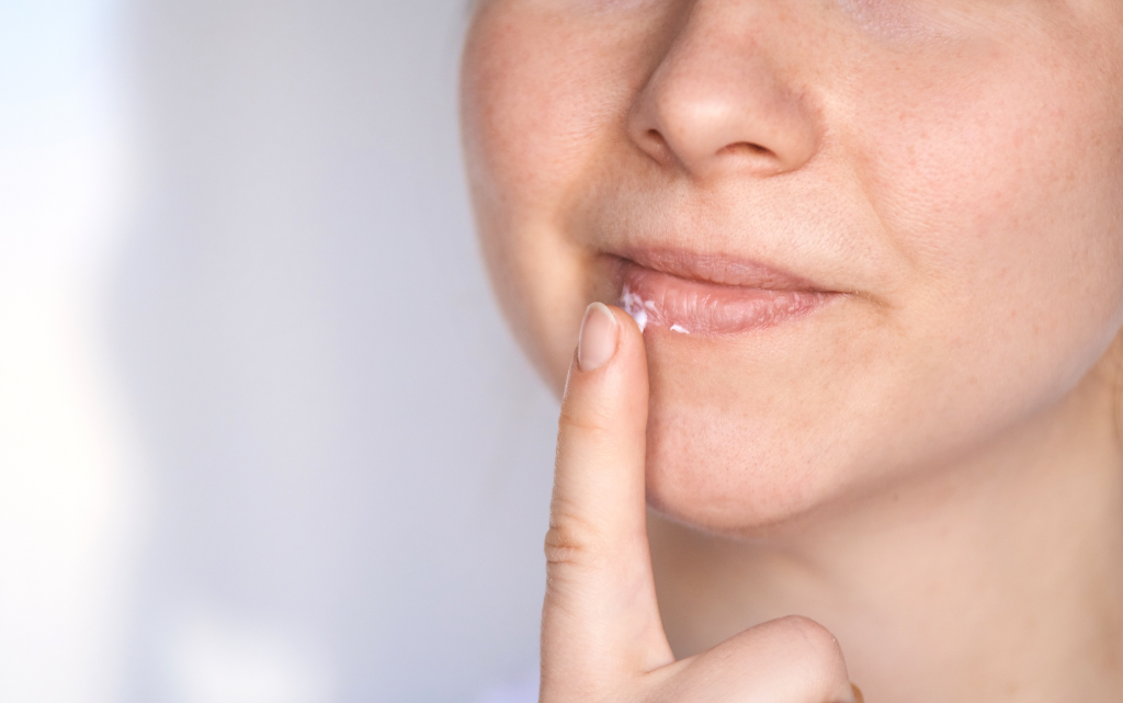 Kobieta nakłada maść na spierzchnięte usta