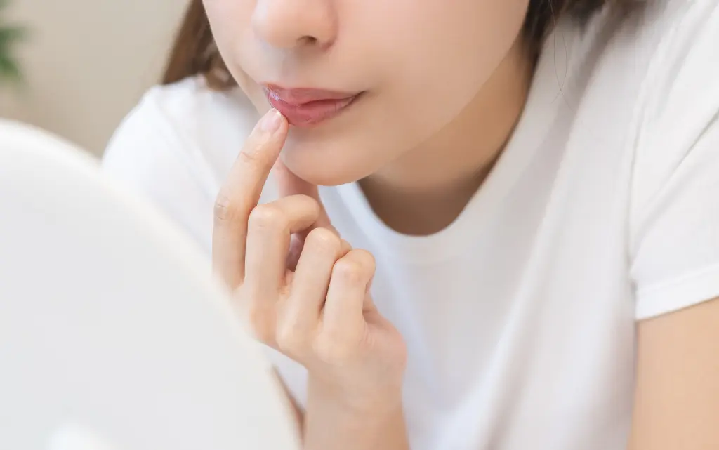 Młoda dziewczyna nakłada maść na popękane, suche usta