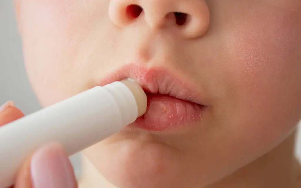 Kobieta nakłada pomadkę ochronną na popękane, suche usta
