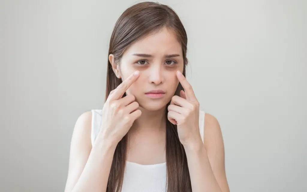 Nastolatka z sinymi cieniami pod oczami