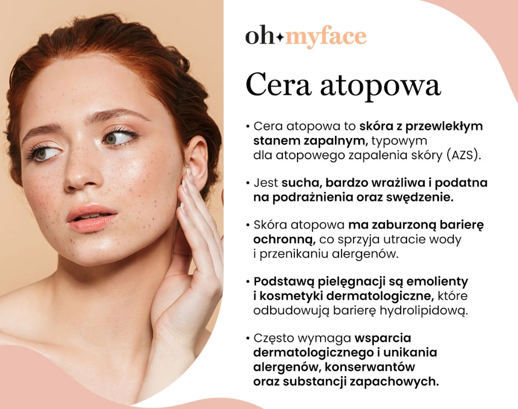Infografika o cerze atopowej Oh My Face