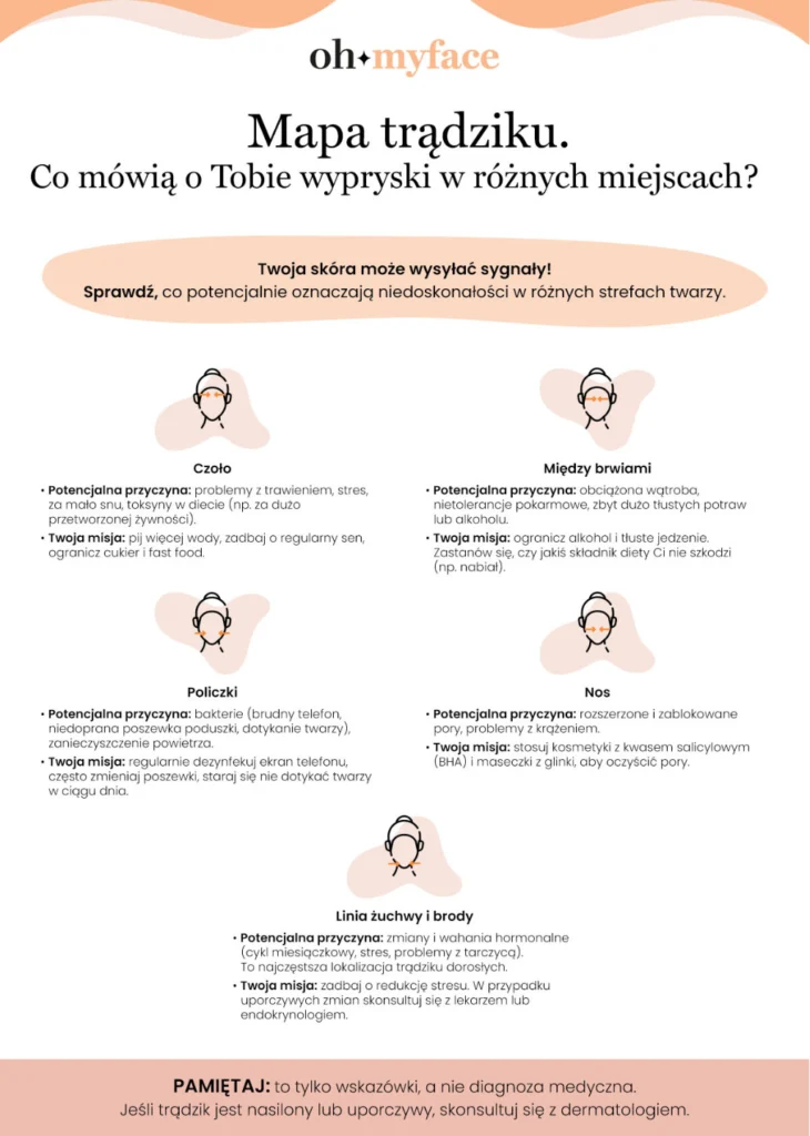 Infografika Mapa trądziku i sposoby jego leczenia