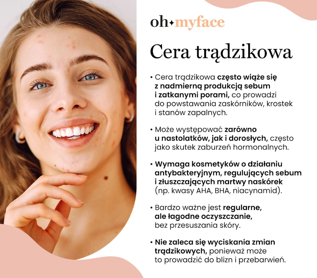Infografika o cerze trądzikowej i jej charakterystyce