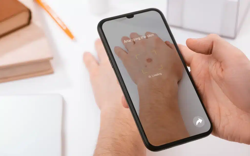 Analiza skóry z użyciem aplikacji AI