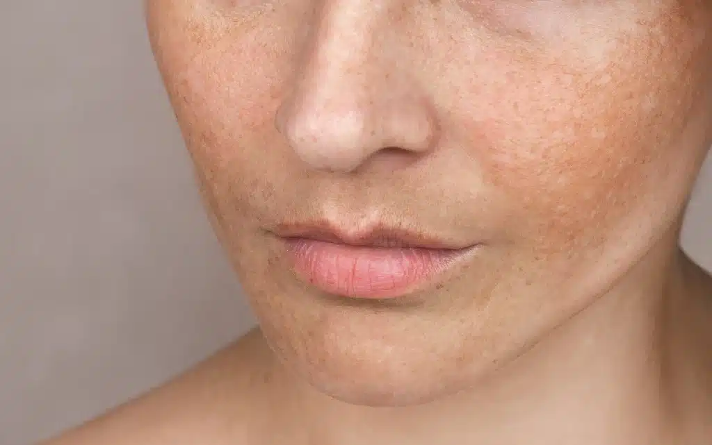 Cera z piegami i przebarwieniami od słońca