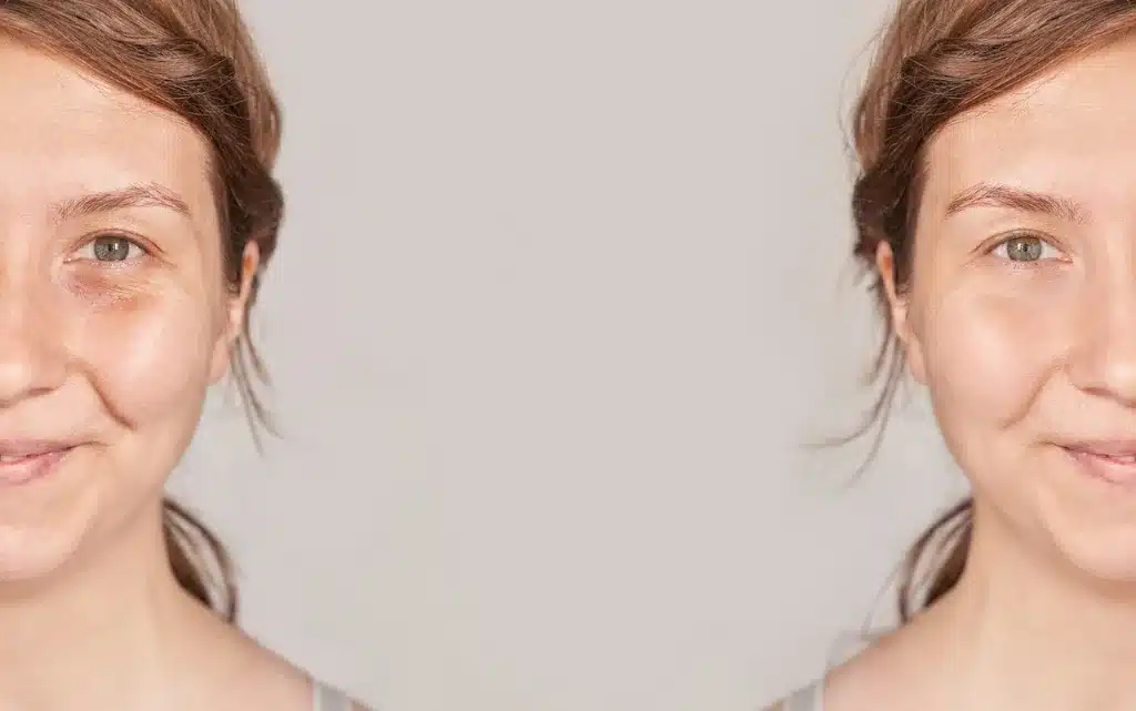 Stosowanie kremu pod oczy na cienie – przed i po