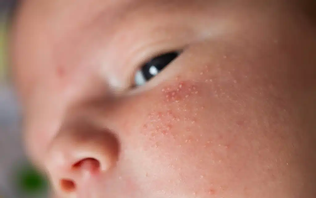 Małe dziecko z kaszką na buzi