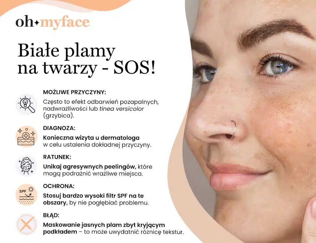 Infografika Oh My Hair o pierwszej pomocy w przypadku białym plam na twarzy