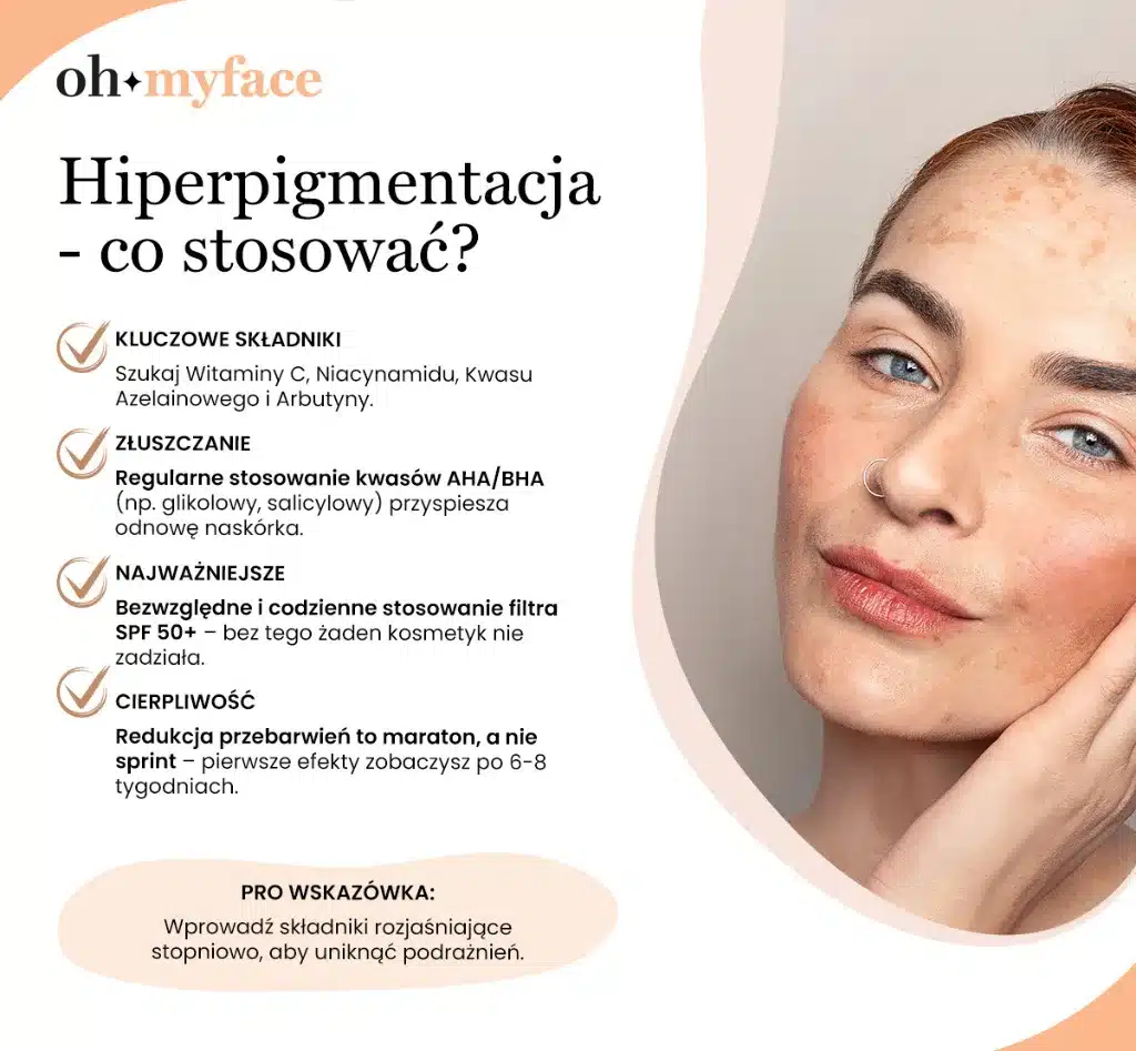 Infografika Hiperpigmentacja co stosować Oh My Face