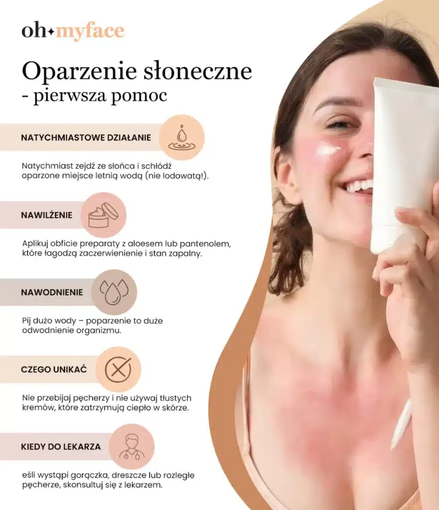 Infografika o pierwszej pomocy przy oparzeniach słonecznych Oh My Face