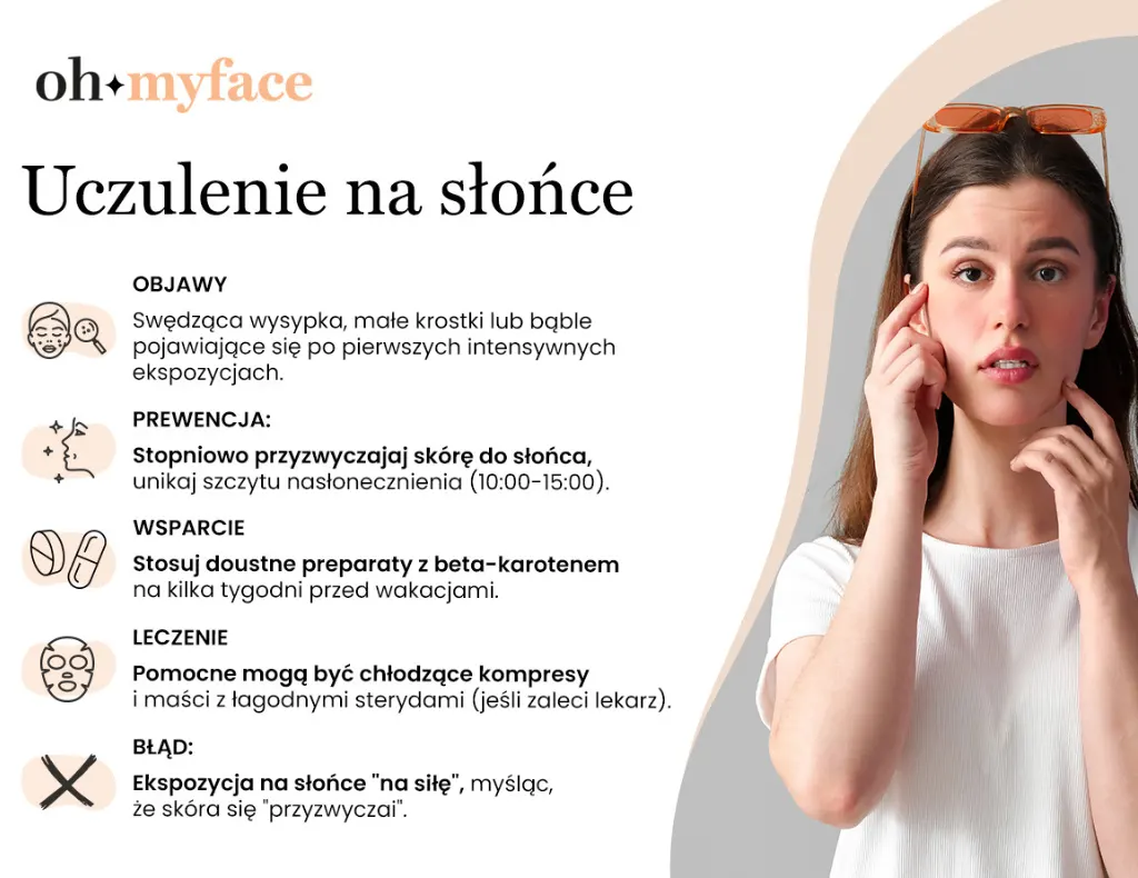 Infografika Oh My Face Uczulenie na słońce: objawy, ochrona, leczenie
