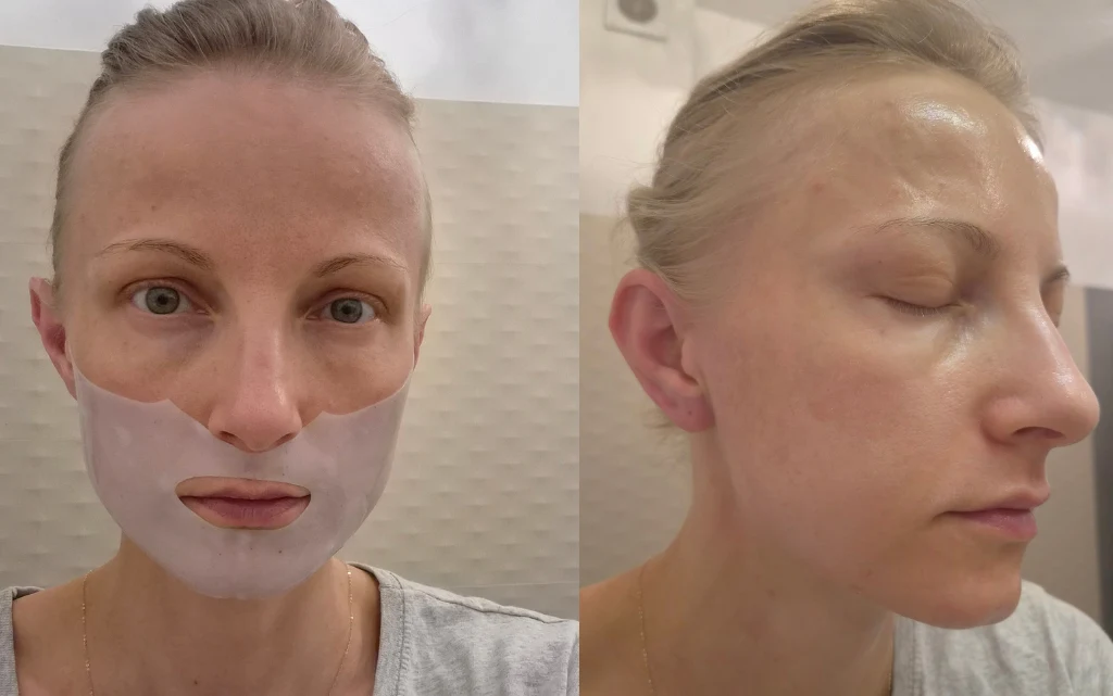 Maseczka żelowa z niacynamidem L’Biotica - nałożona i efekt